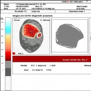 Micro CT